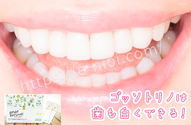 ゴッソトリノホワイトニング歯を白くする効果